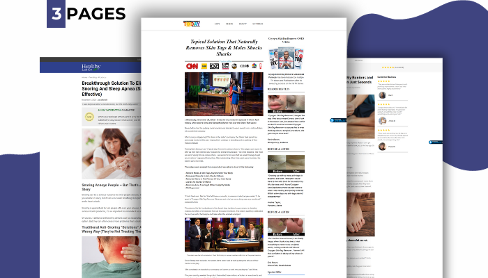 advertorial page templates